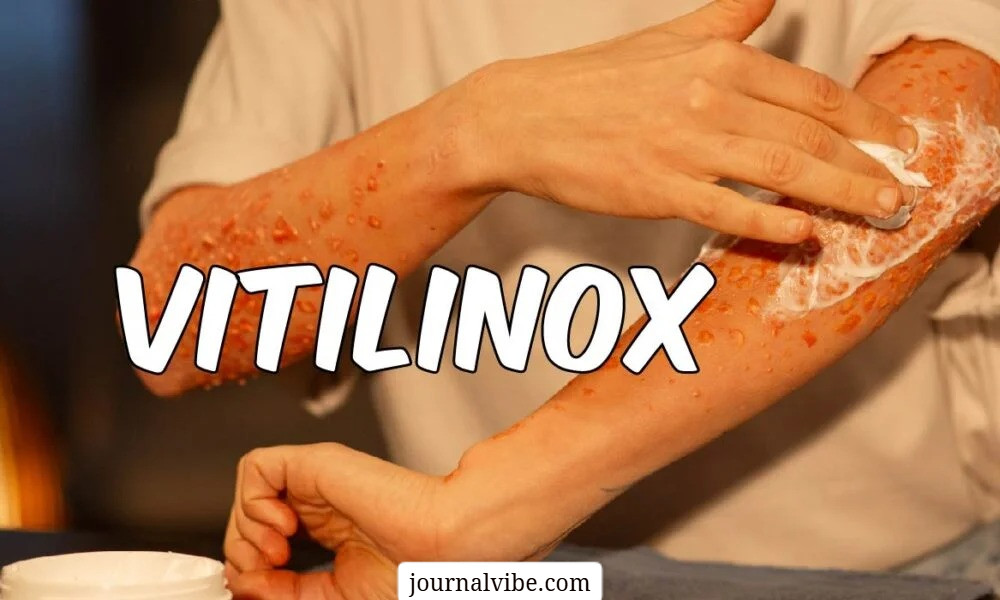 vitilinox
